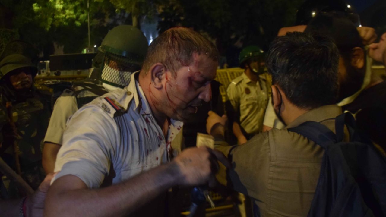 ‘मेरे पिता घर आए तो खून से लाल थी वर्दी’, जंतर-मंतर झड़प में घायल पुलिसकर्मियों के परिवारों का छलका दर्द